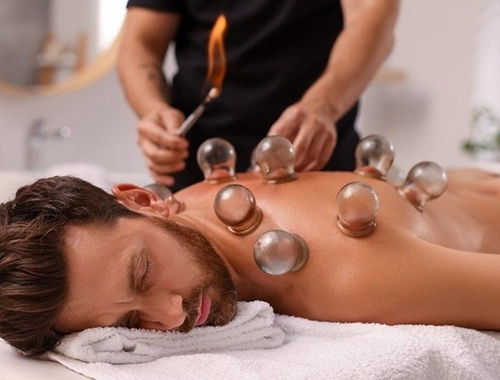 Cupping Therapy